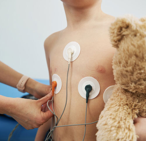 holter-testing